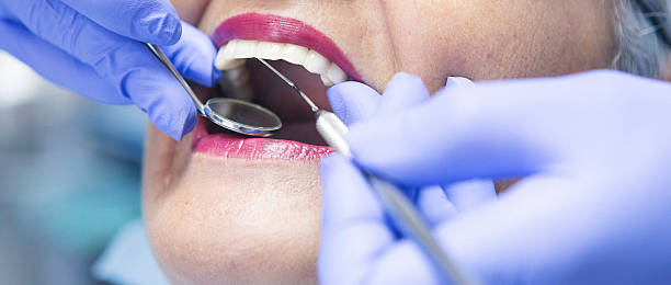 Best Emergency Denture Repair in Hauppauge, NY